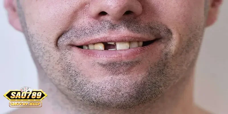 Giải mã về giấc mơ thấy rụng răng chuẩn xác