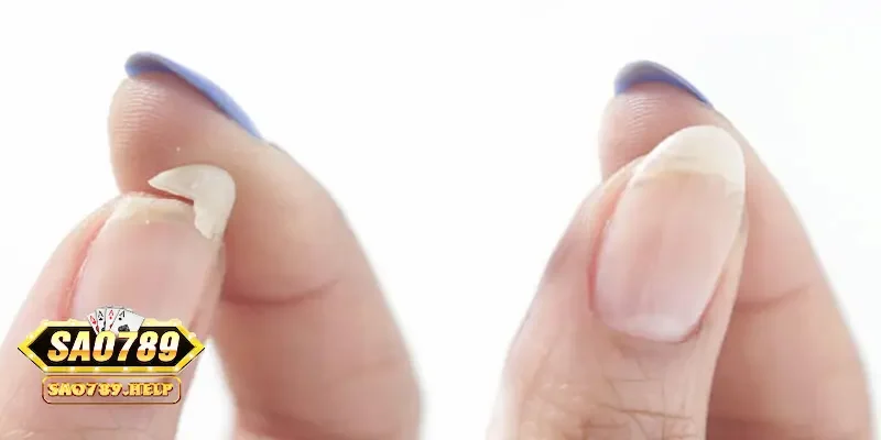 Mơ thấy ngón tay bị thương – sự tổn thương và lời cảnh báo 